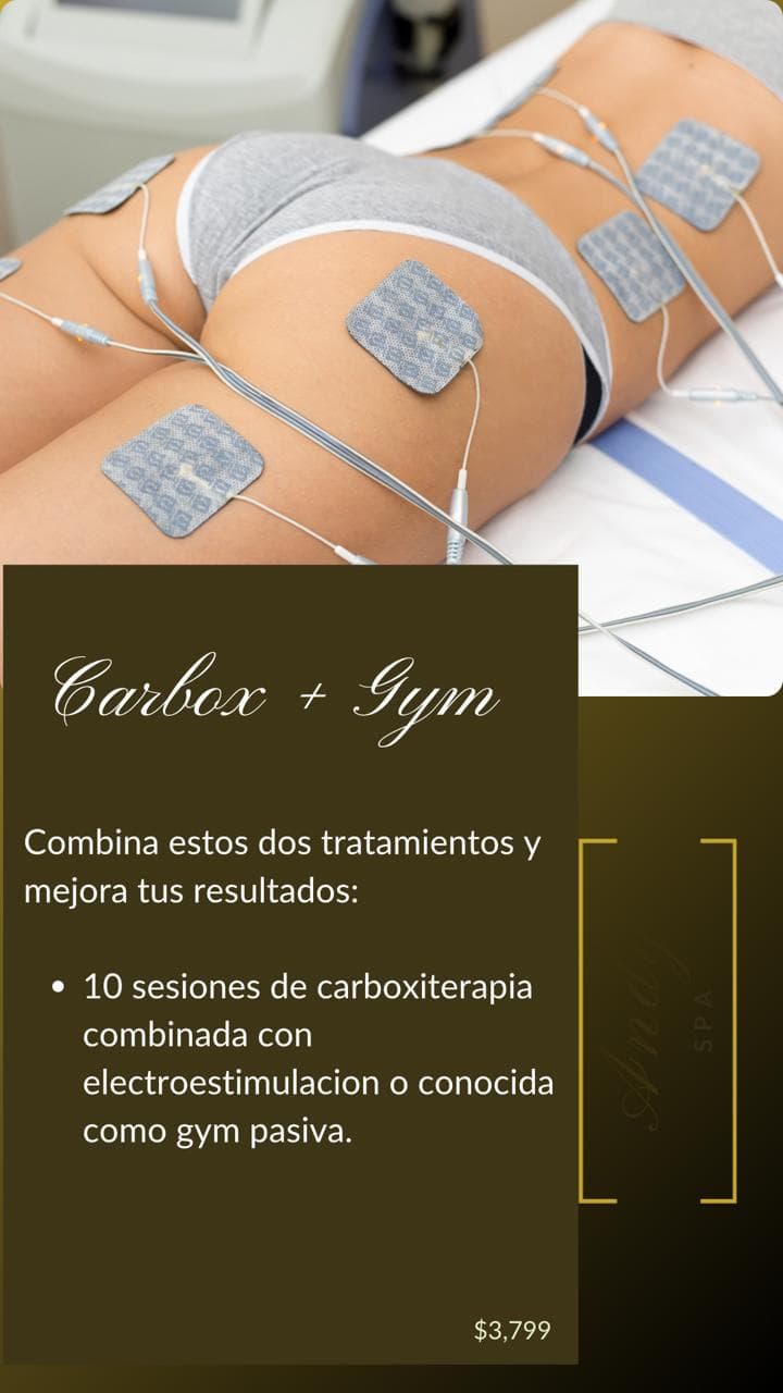 Andy Spa Ciudad Guzmán photo