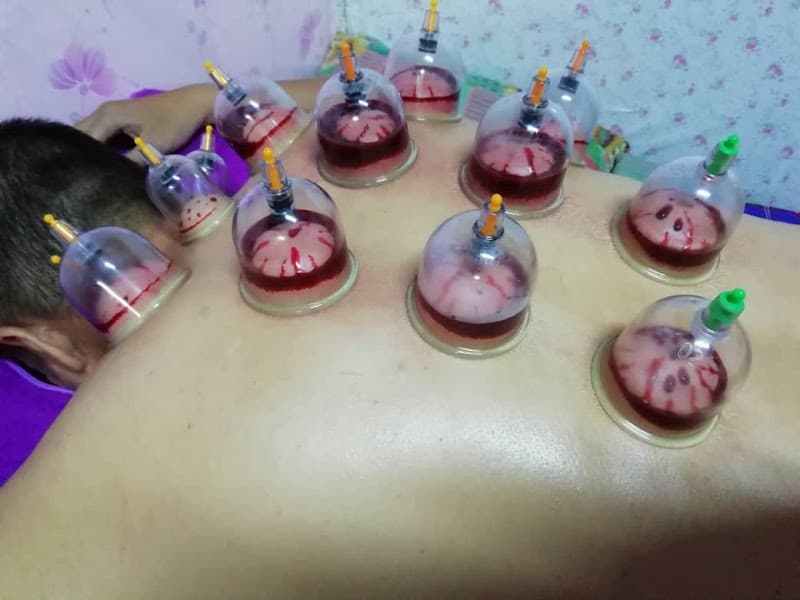 Bekam Darul Mukhtar Ampang photo