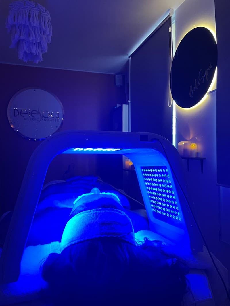 Belespa Irapuato photo