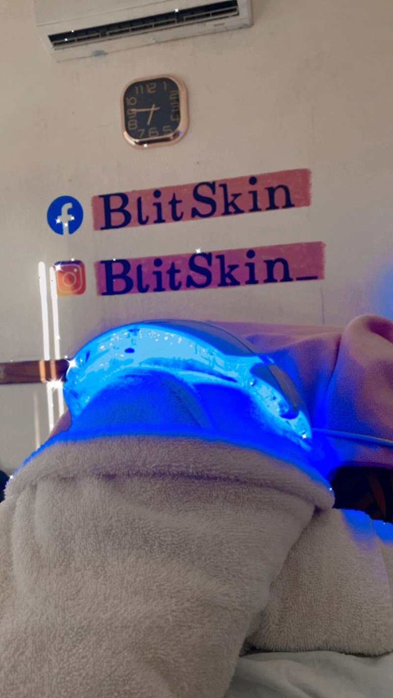 BlitSkin Miguel Alemán photo
