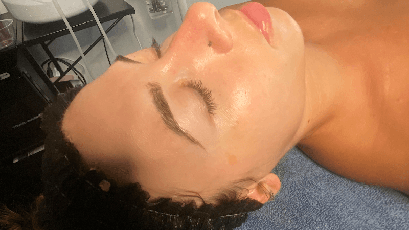 Bloomglow esthetics Margate photo