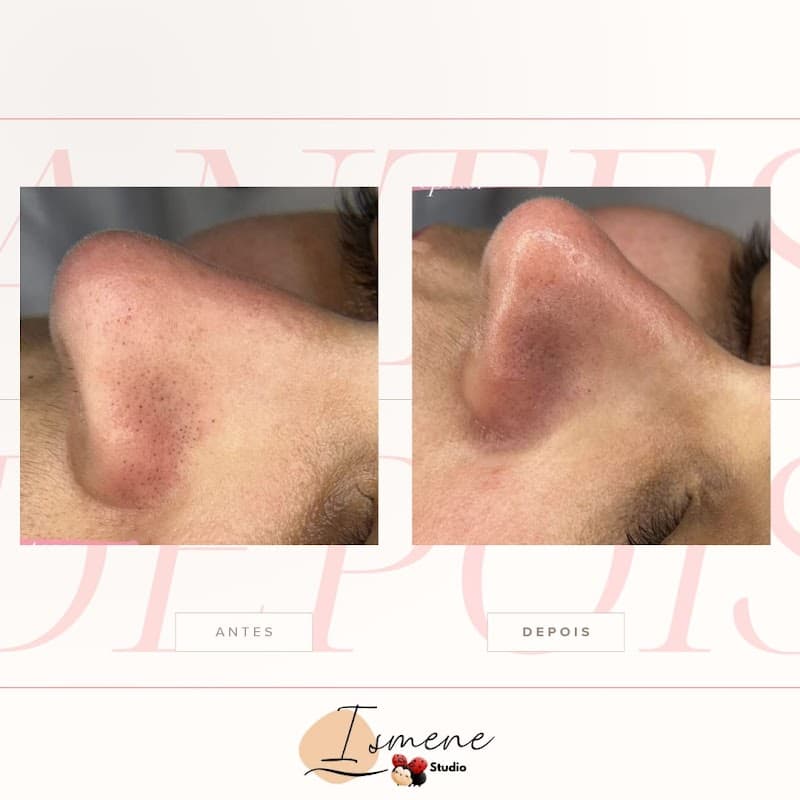 EE estética e pilates Osasco photo
