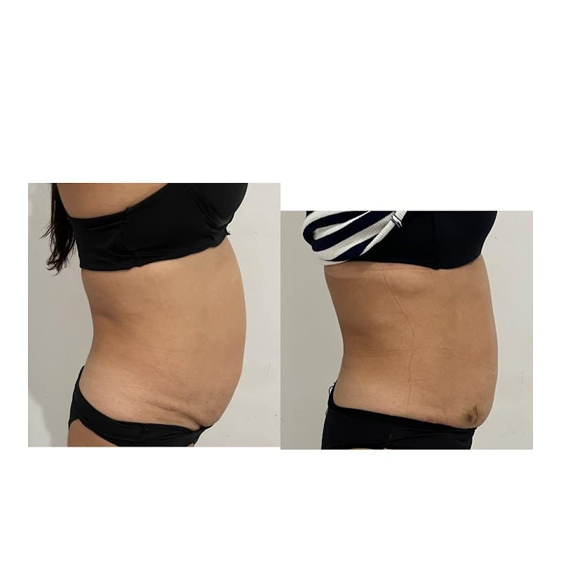 Fisio e Estetica Apuiarés photo
