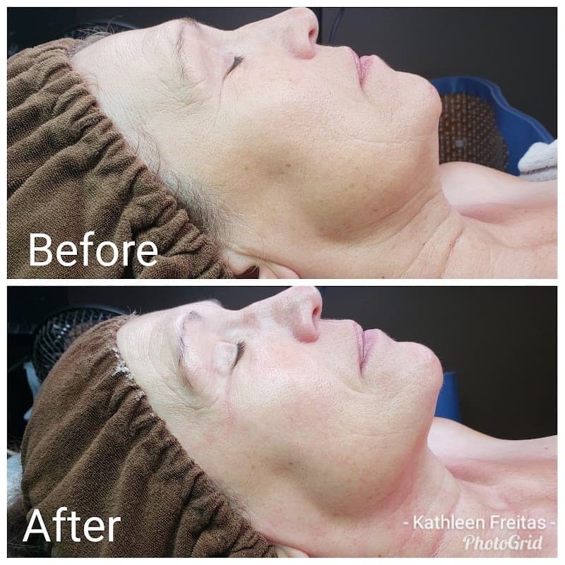 Jovem Spa Chowchilla photo