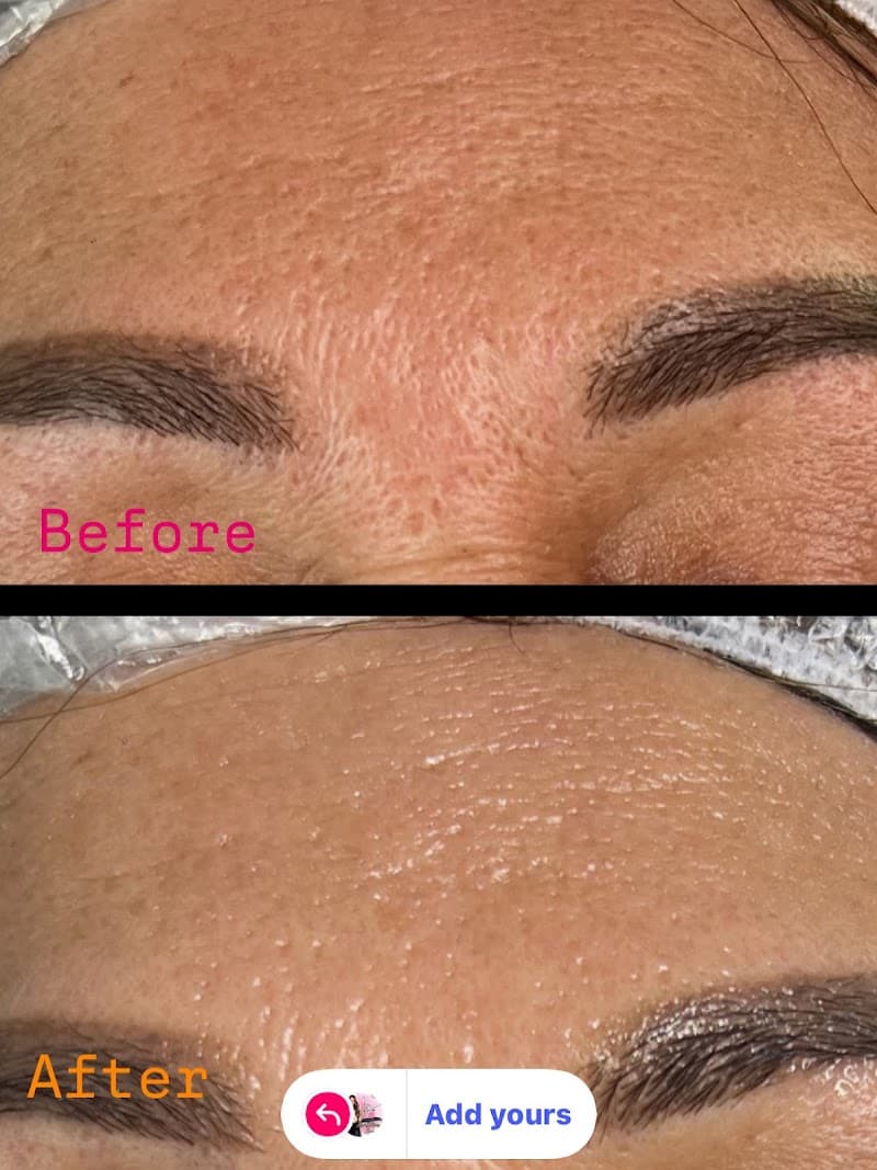 Lina lumina spa Gastonia photo