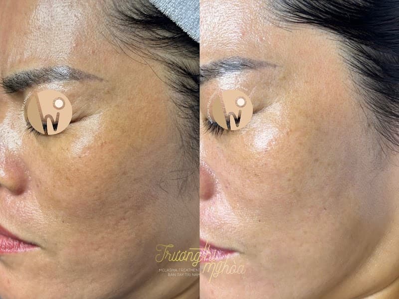 Loveskin Spa Quận 4 photo