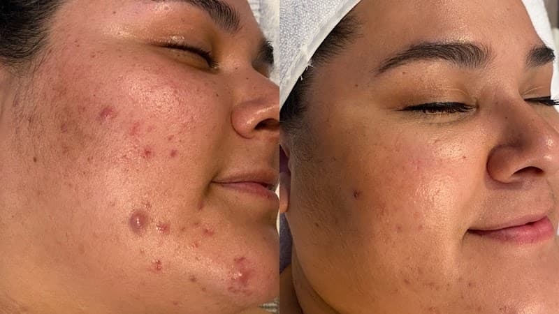 Madejca Esthetics Lodi photo