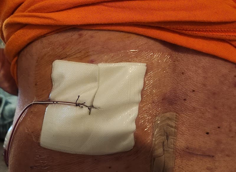 Neuromicrospine Destin photo