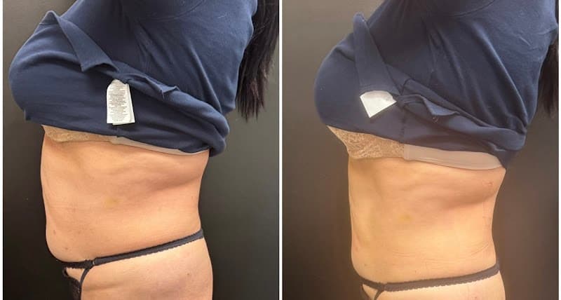 Premier Body Shaping Davie photo