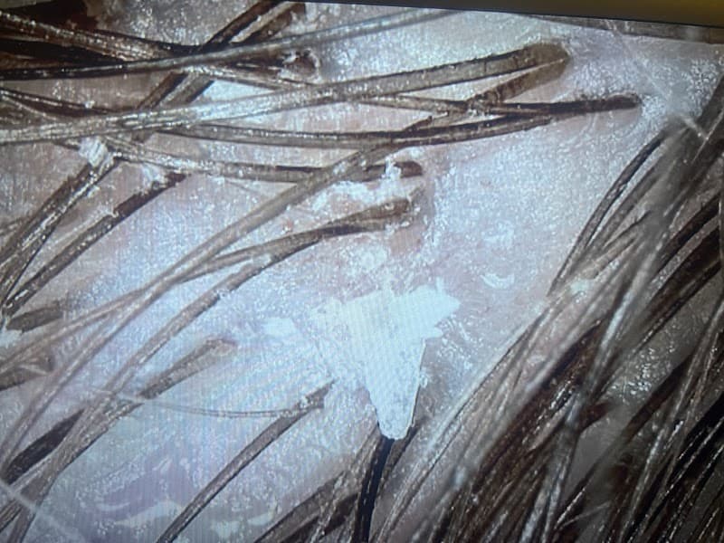 Pure Scalp Spa Brookfield photo
