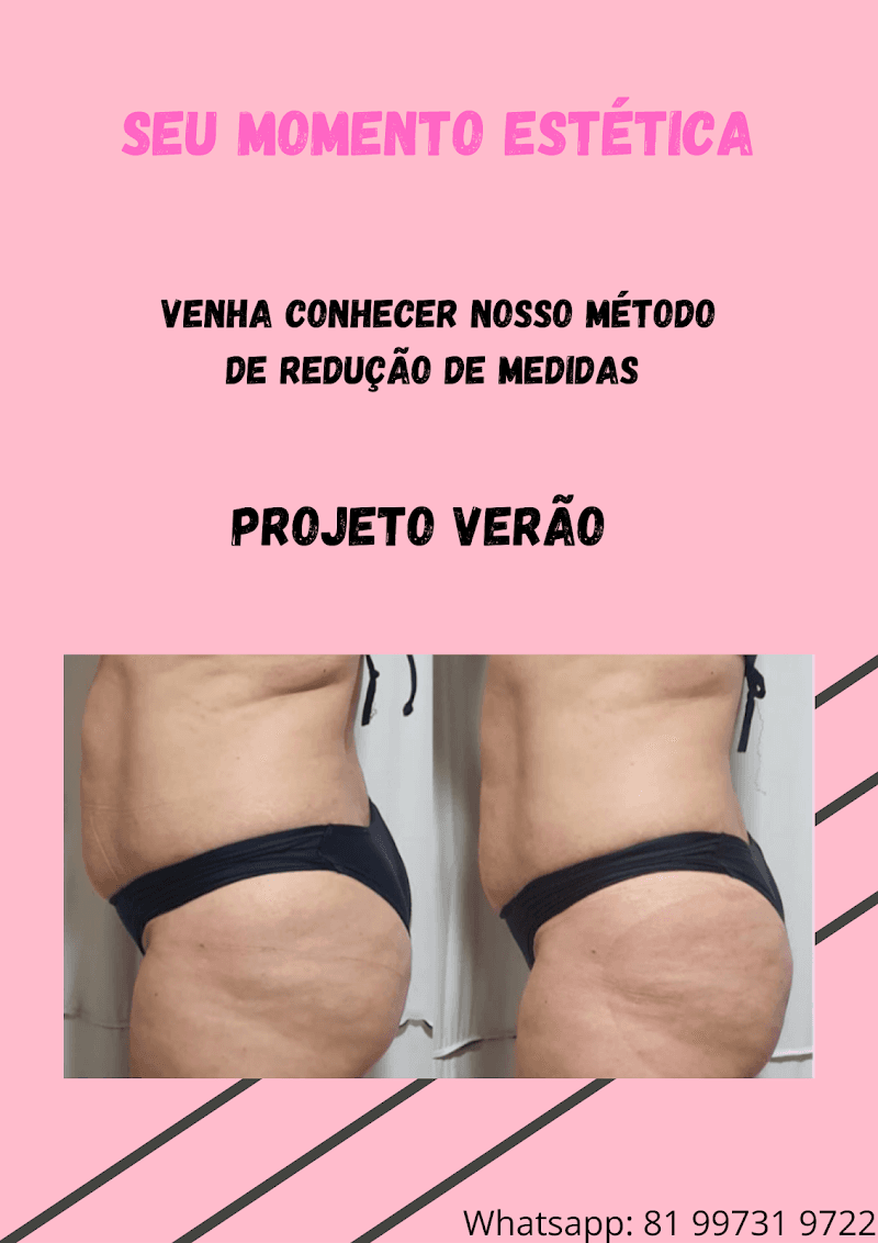Seu Momento Estética Recife photo