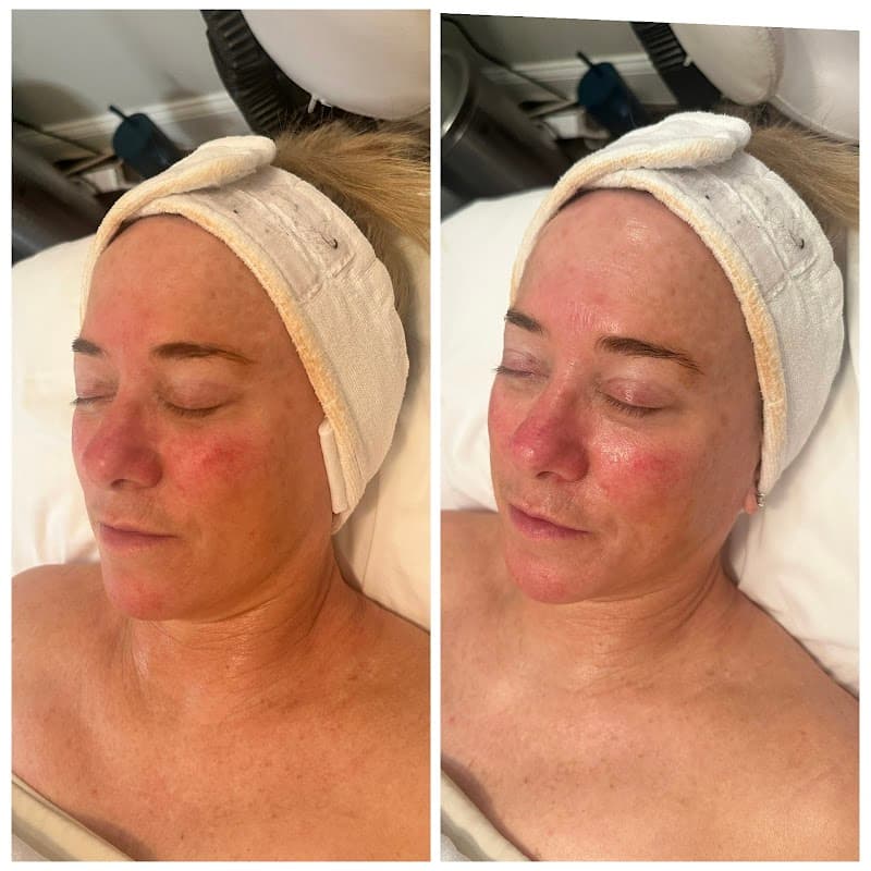 Spa Larimar New Bedford photo