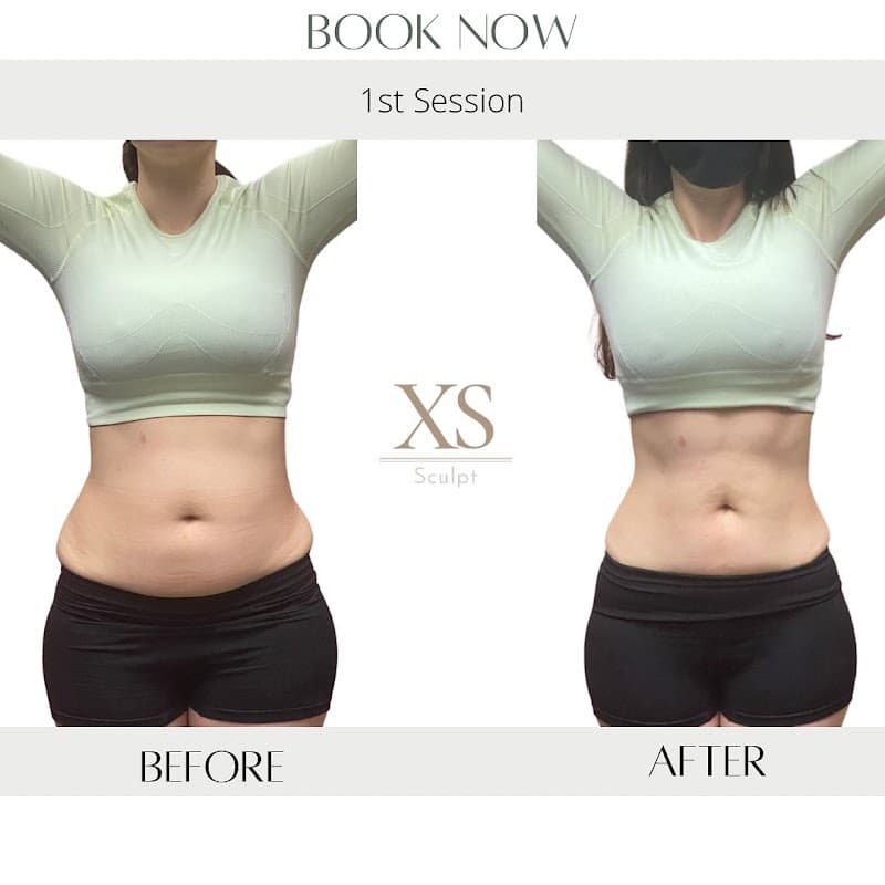 XS Sculpt Garden Grove photo