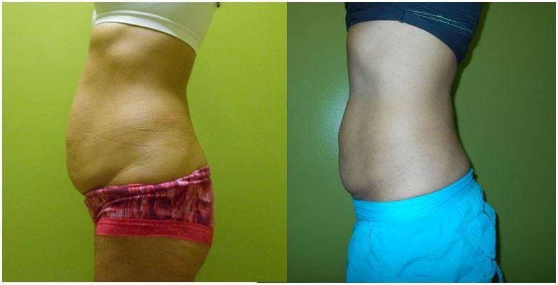 7 E Fit Spa of Littleton photo