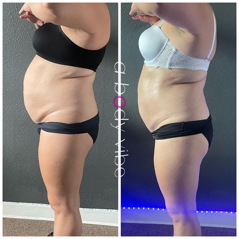A Body Vibe Body Contouring Holiday photo