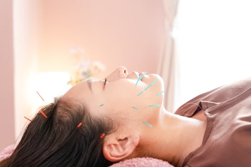 Acupuncture Salon hikari Kita Ward, Nagoya photo
