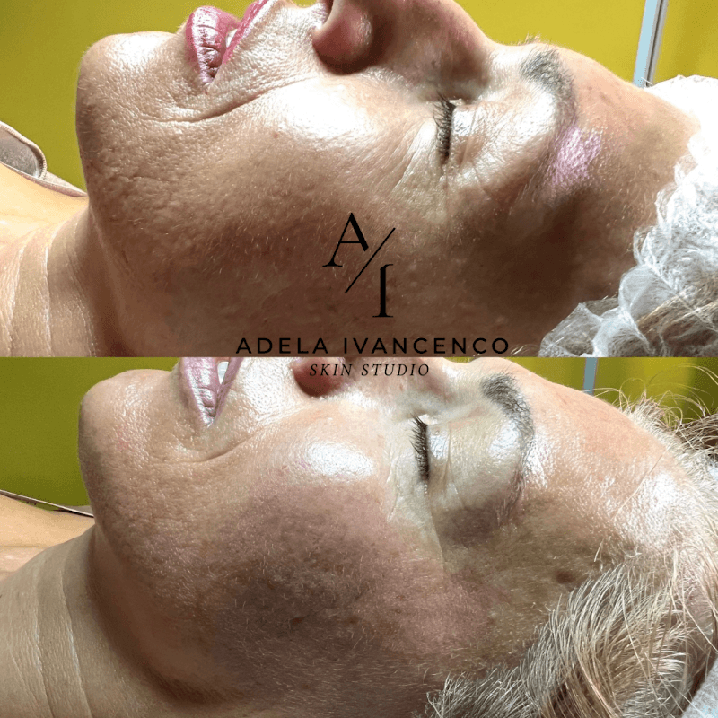 Adela Ivancenco Skin Studio Trieste photo