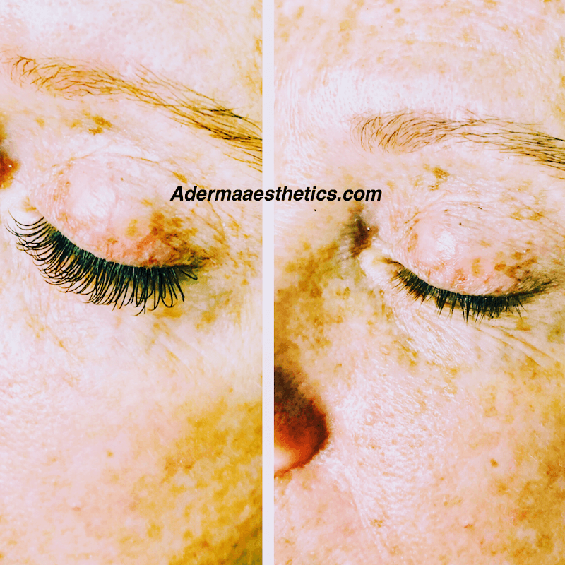 Aderma Aesthetics Pompano Beach photo