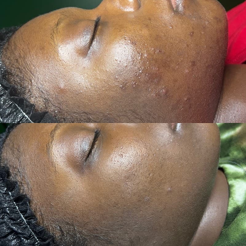 Aesthetics and Massage by Nichole Greenville photo