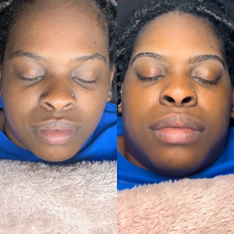 Aesthetics By Angeleana Lafayette photo