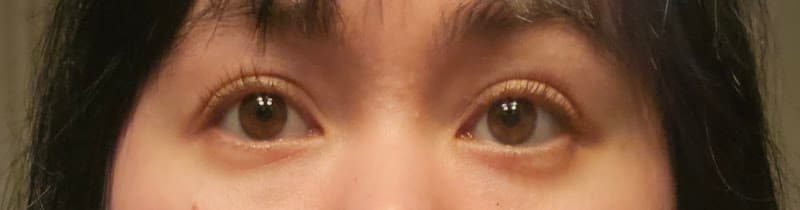 Airess Skin Studio Seattle photo