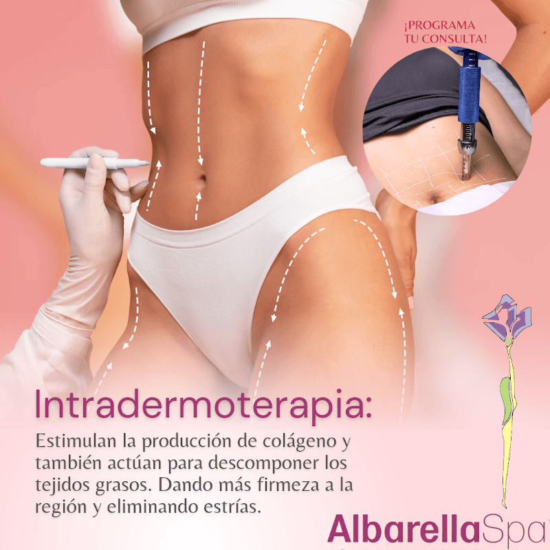 Albarella spa Xalapa de Enríquez photo