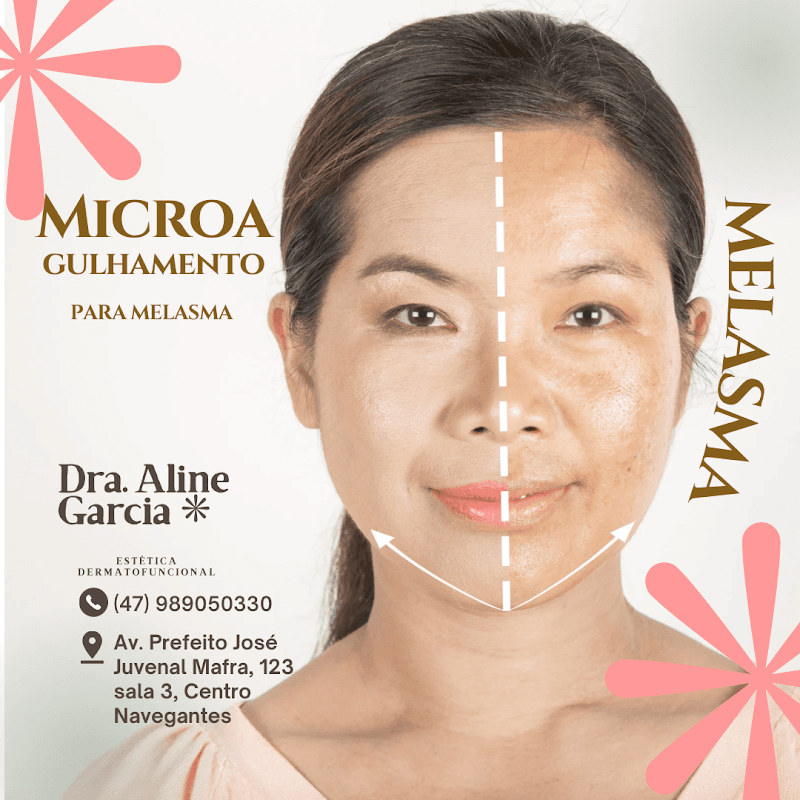 Aline Estética Marcelino Ramos photo