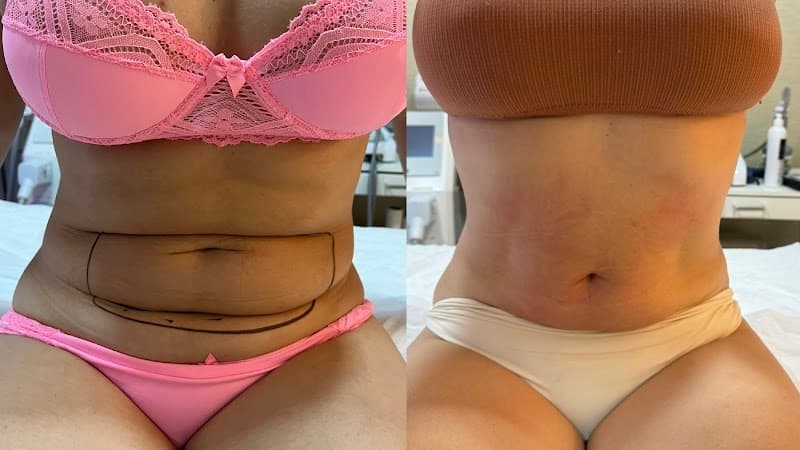 Aline Lanzoni Estetica de Resultado Jales photo