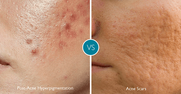 Alinea Medical Spa Acne Scar & Laser Skin Care NYC New York photo