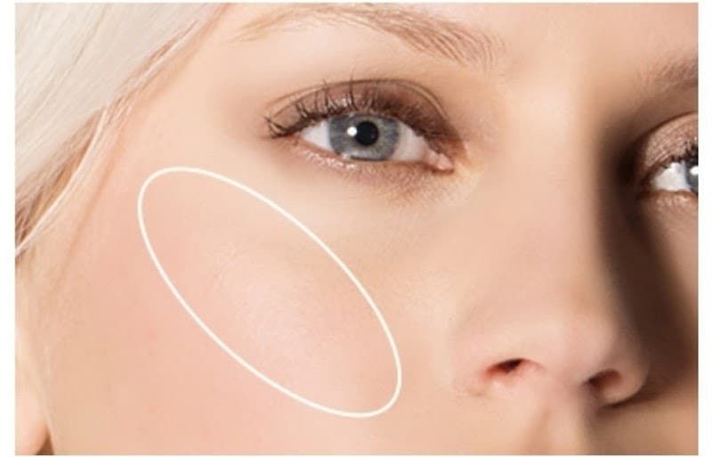 Alivio al Instante con Nube Marbella photo