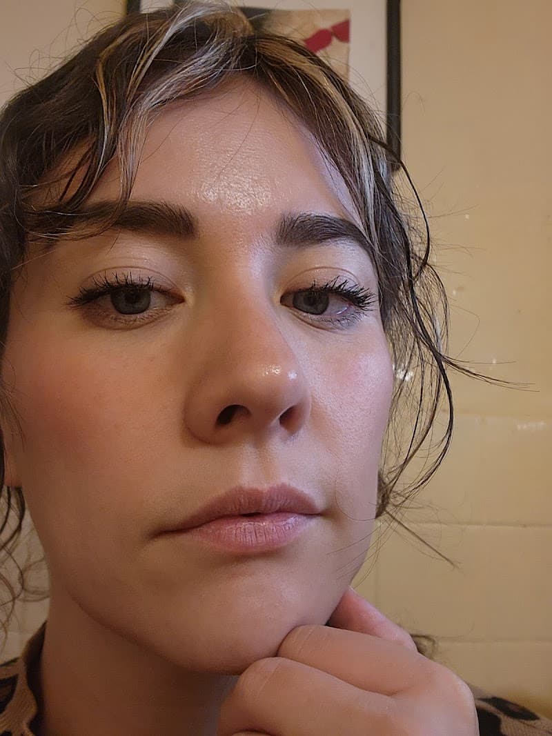 ALLURE Medicina Estética Mexico City photo