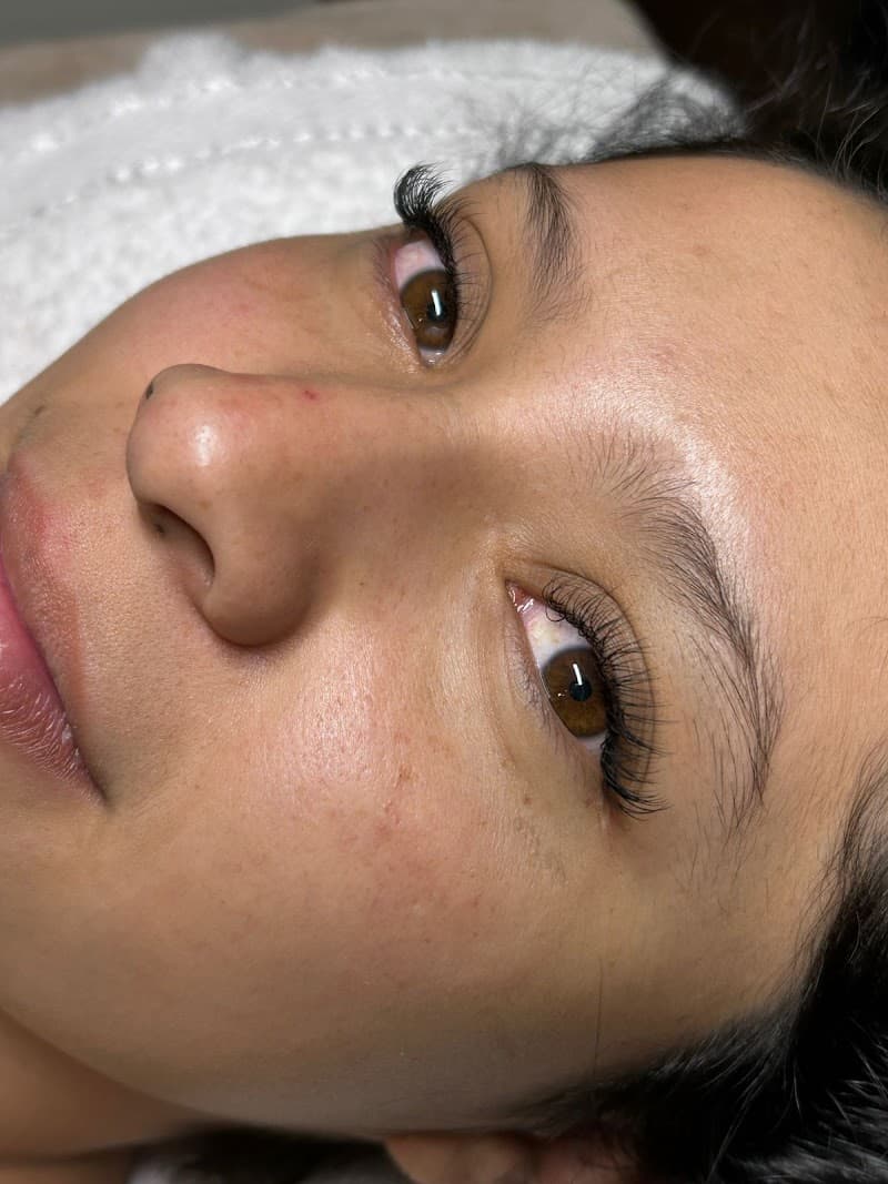 Almery Skin Center Puebla photo