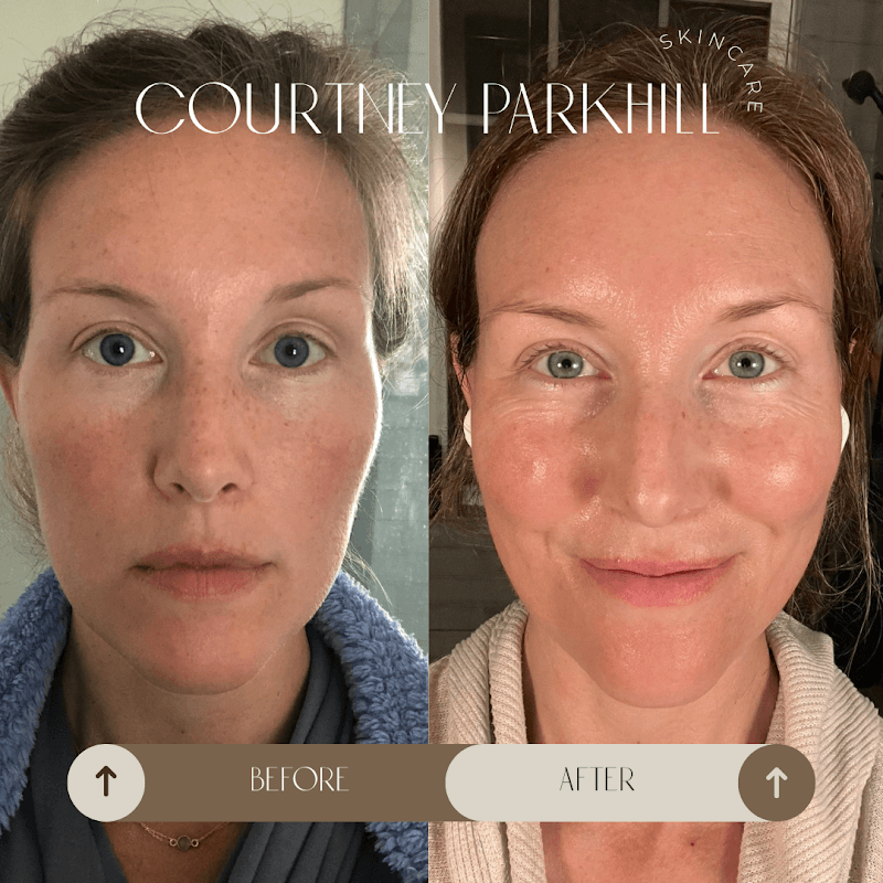 Alpenglow Skin Spa Colorado Springs photo