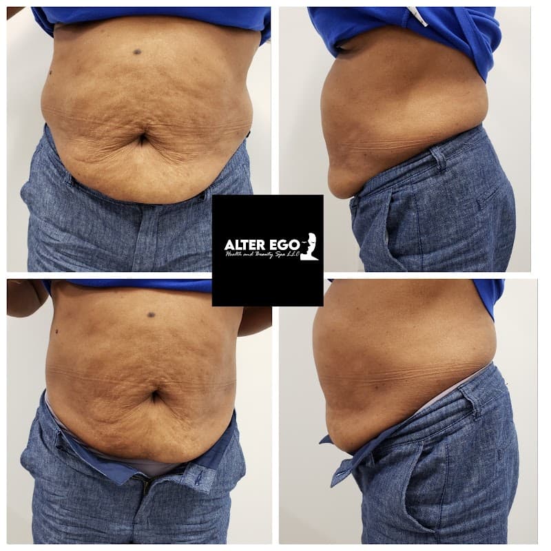 Alter Ego Health and Beauty Spa Chesapeake photo