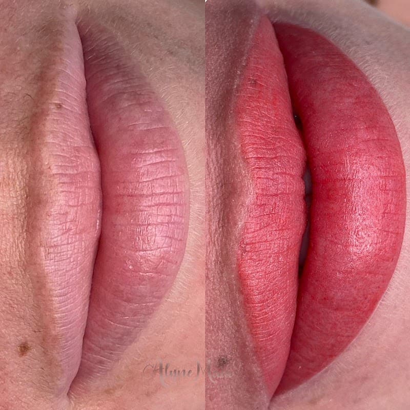 Alyne Maia Estética Avançada e Integrativa Foz do Iguaçu photo