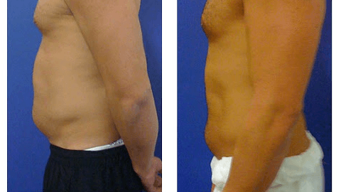 Amazing Weight Loss Centre Lagos photo