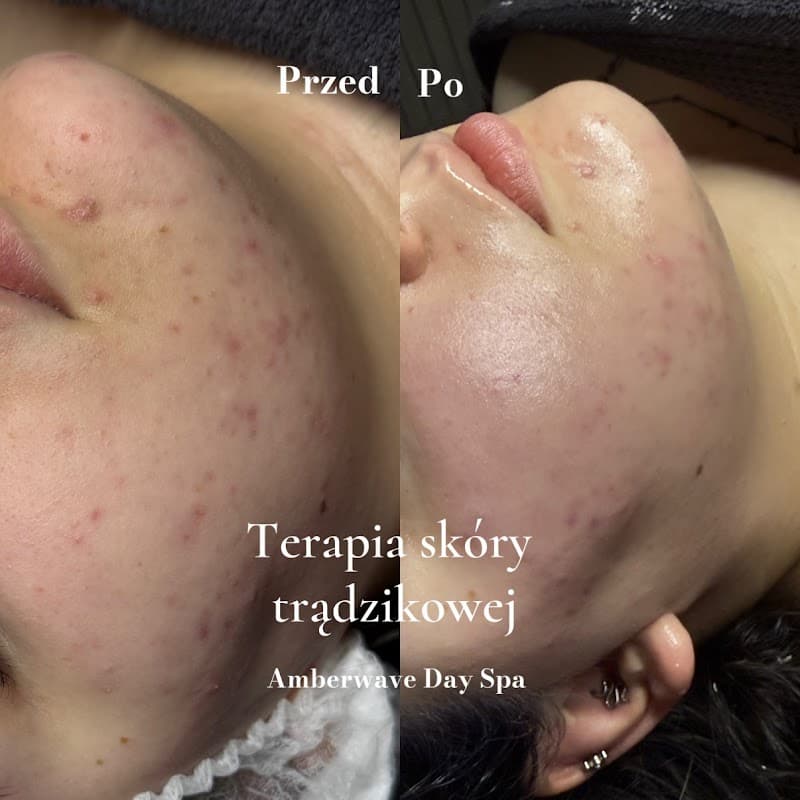 Amberwave Day SPA Jastarnia photo