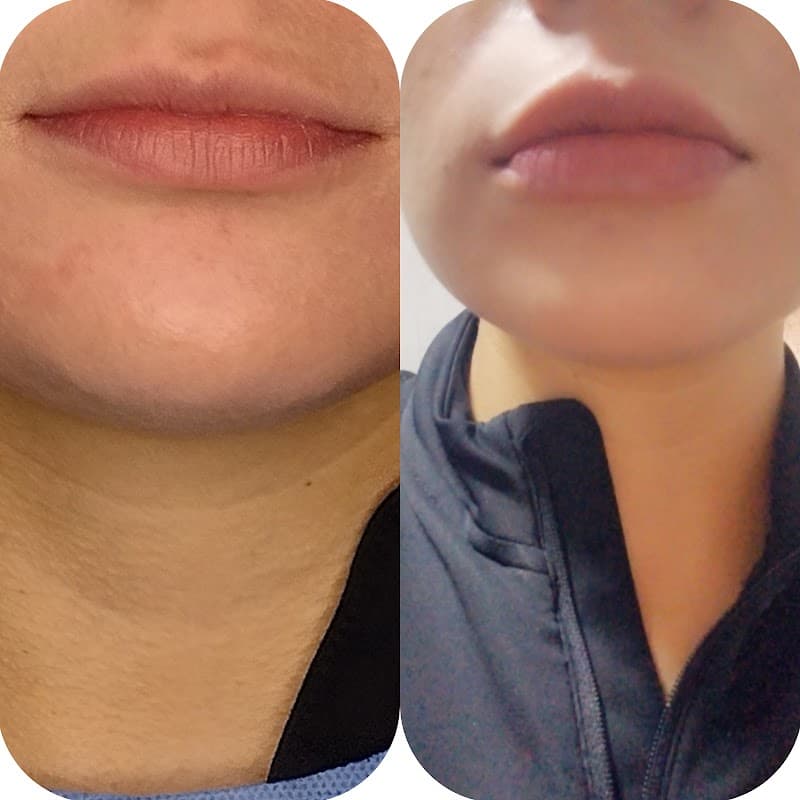 Ananda Spa CDMX Cuauhtémoc photo