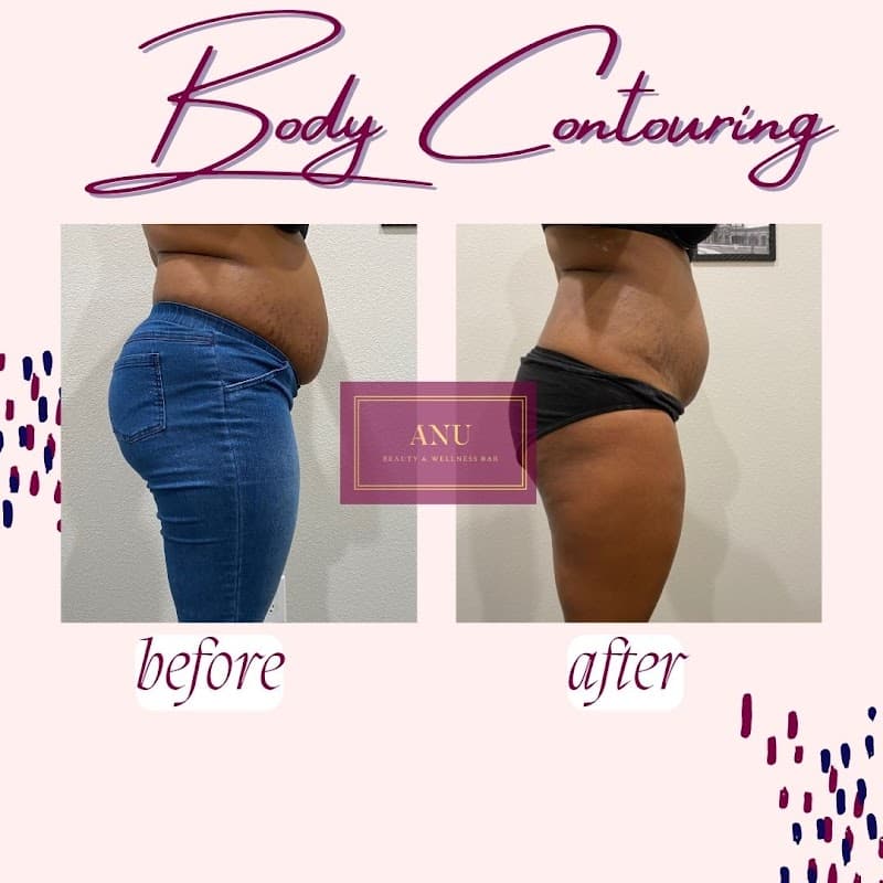 ANU Beauty & Wellness Bar Missouri City photo