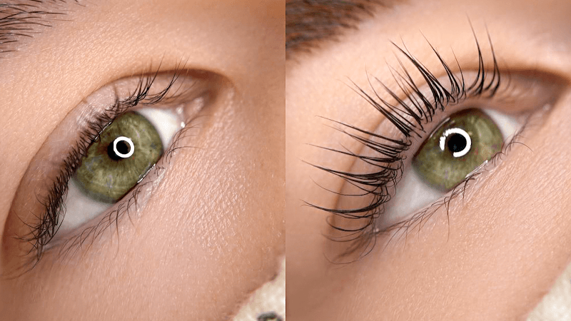 Arlington Laser Lipo/Celebrity Lash Boutique photo