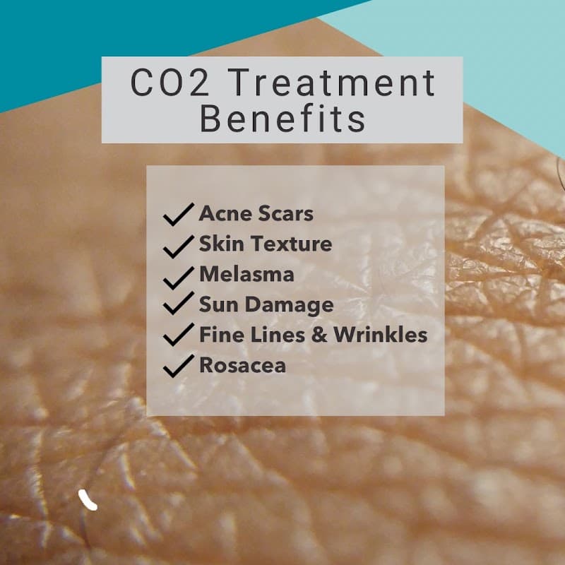 Aspire Medical Spa - Arvada photo