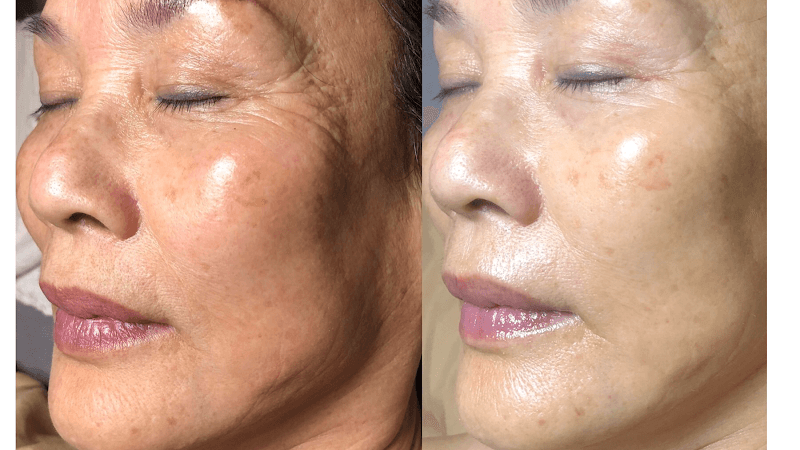 Aura Skin Care Spa Avon photo
