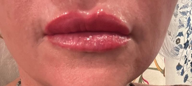 Aura Skin & Wellness Center Cape Girardeau photo