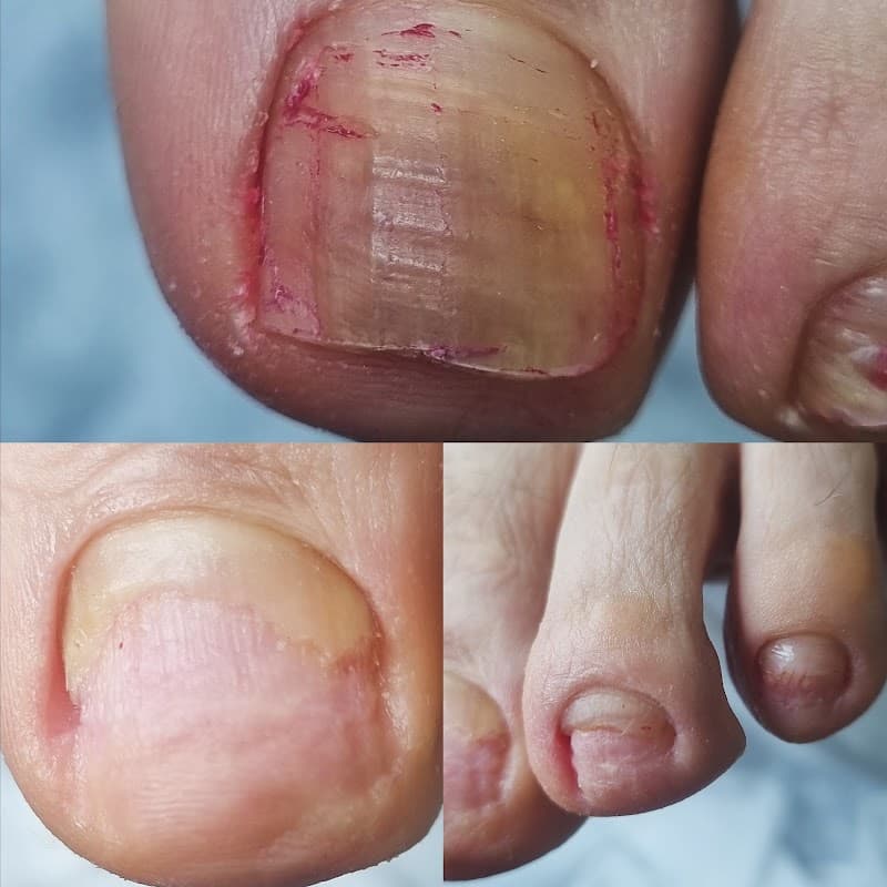 Ayak Bakımı Narlıdere photo