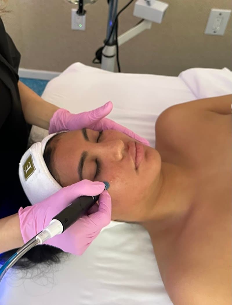 Baby Face Skin Care Denver photo
