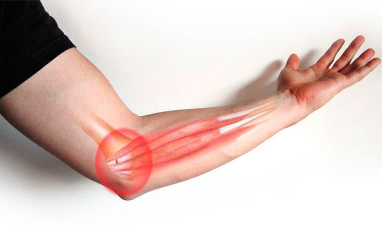 Baja Clinic Fisioterapia y Rehabilitación La Paz photo