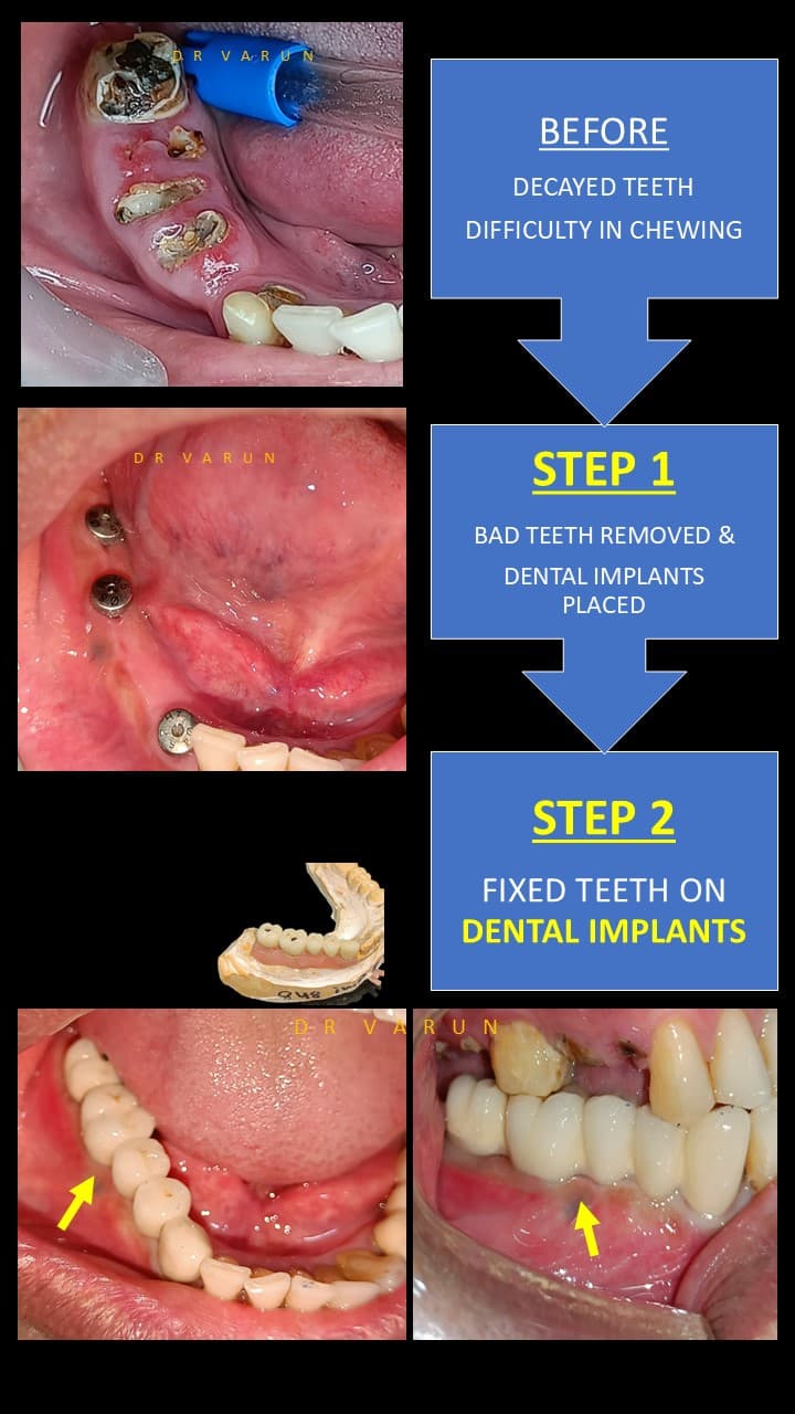 Bandhu Dental Clinic Delhi photo