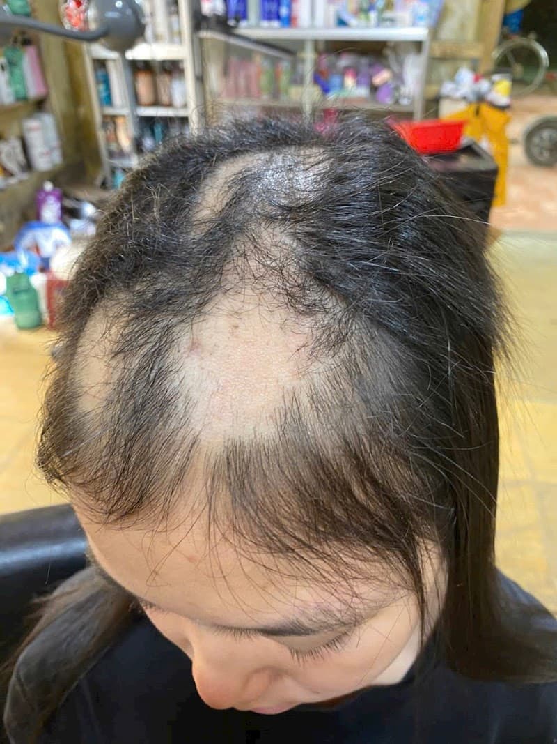 Bảo An 89 Spa Beauty and Academy Vĩnh Yên photo