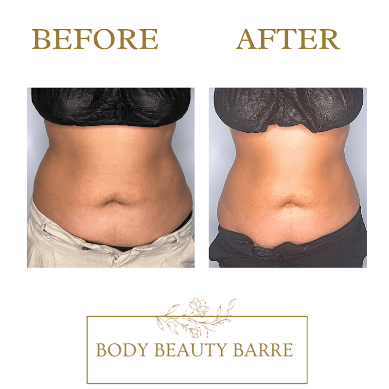 Beauté Barre Dallas photo