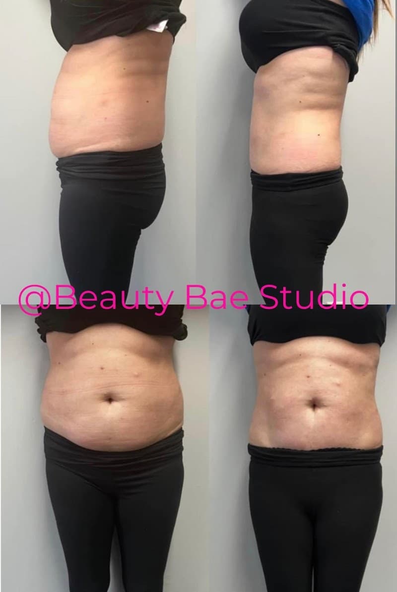 Beauty Bae Studio Body Spa Monona photo